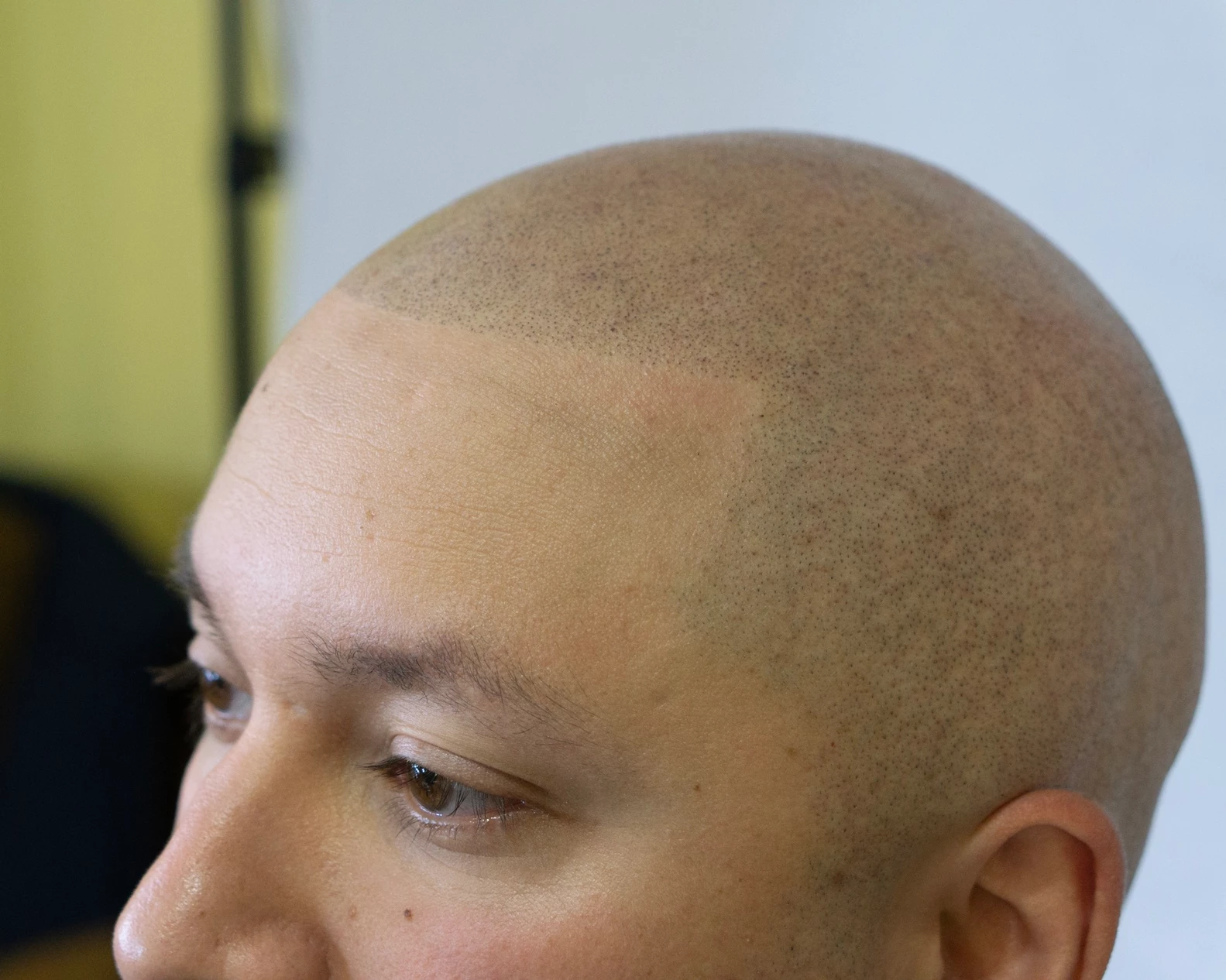 Blog Edge Scalp Ink in Bethesda Maryland