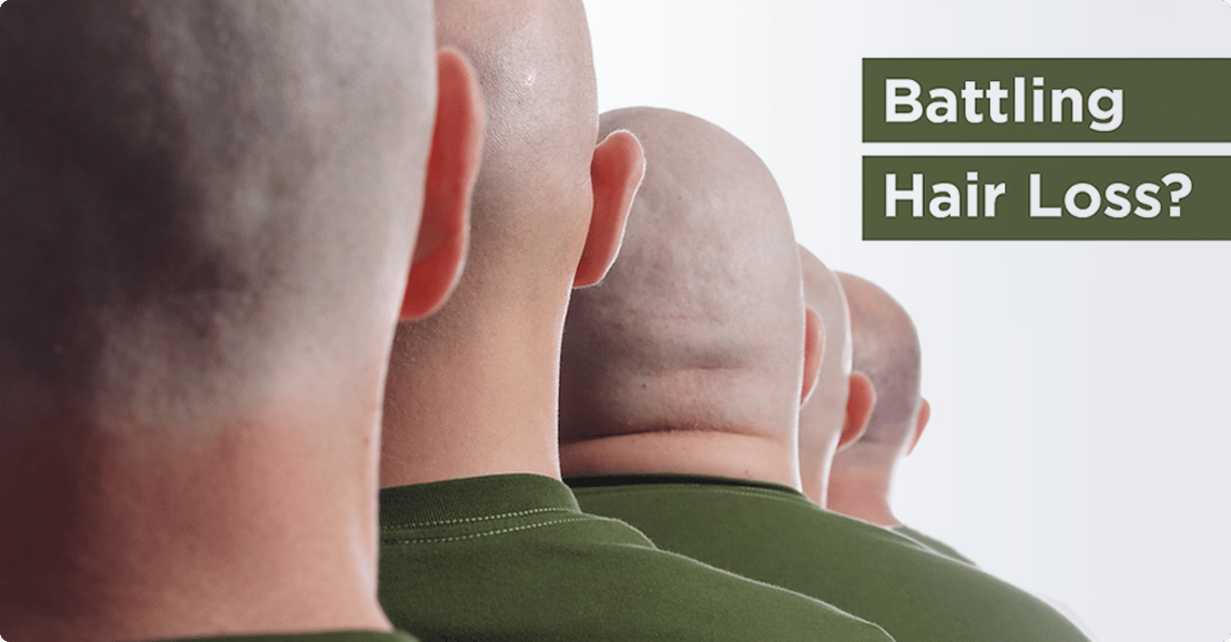 Military discount for scalp micropigmentation treatment at Edge Scalp Ink