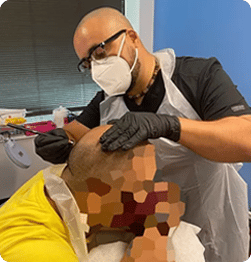 ruben - Edge Scalp Ink
