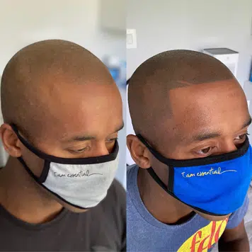 before and after black African American man scalp micropigmentation SMP