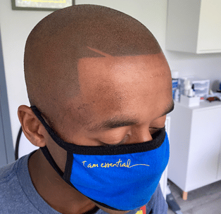 After photo of scalp micropigmentation treatment on black man