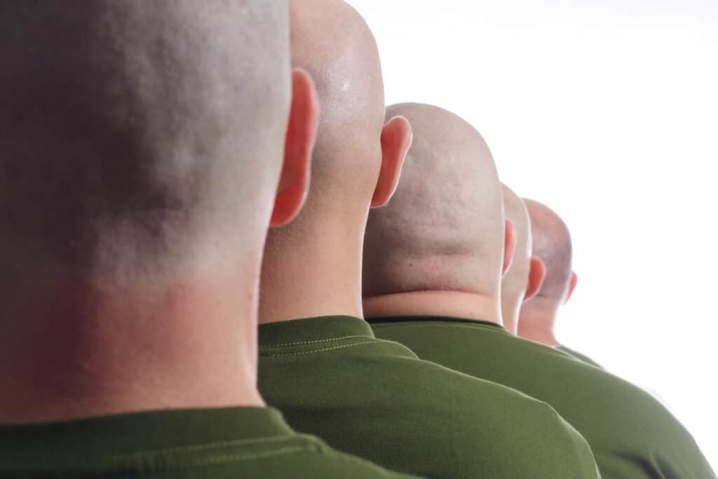 High and Tight Military Haircut Scalp Micropigmentation Treatment for Officers